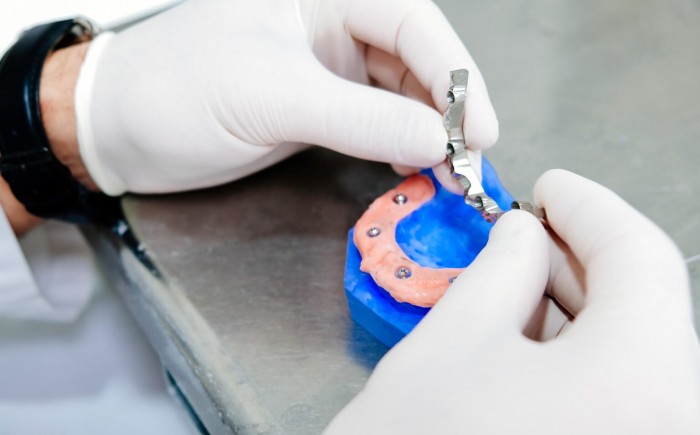 Laborator tehnica dentara - Tehnica dentara DENTALOFFICE-CJ.RO