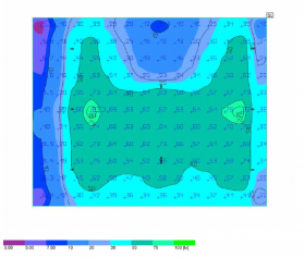 Siguranță și estetică: Soluție completă de iluminat pentru Parcarea Clinicii Regina Maria Oradea